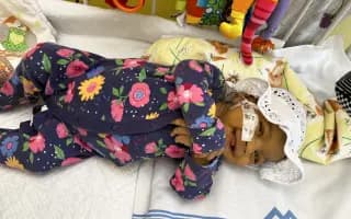 Helenke môže život zachrániť transplantácia pečene. Pomôžme jej.