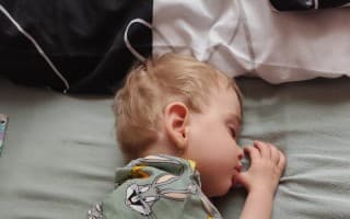 Malá bojovníčka Emmka si za prvý rok svojho života vytrpela veľa, no bojuje ďalej